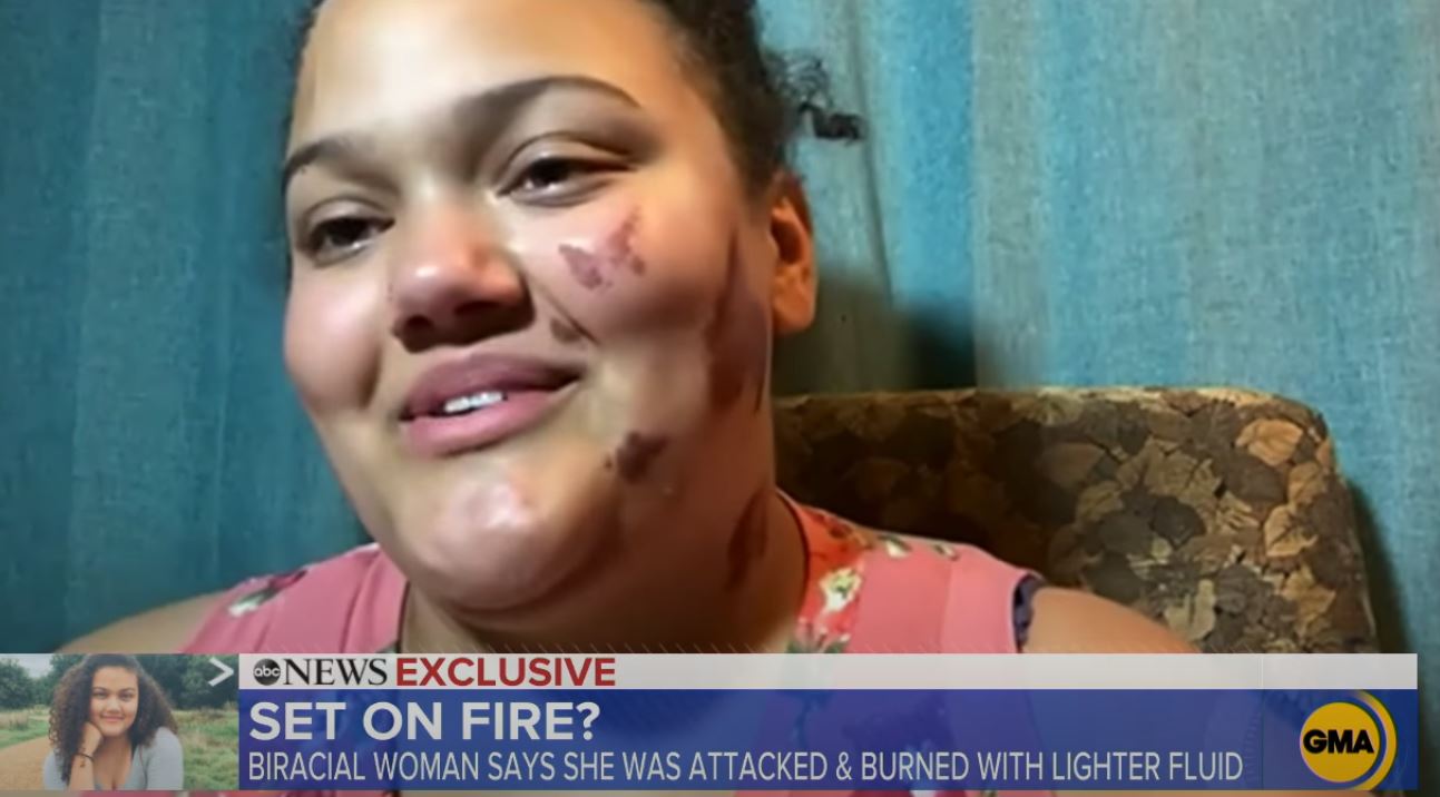 Prosecutors Close Investigation Into Alleged Hate Crime Against Biracial Woman Citing Lack Of