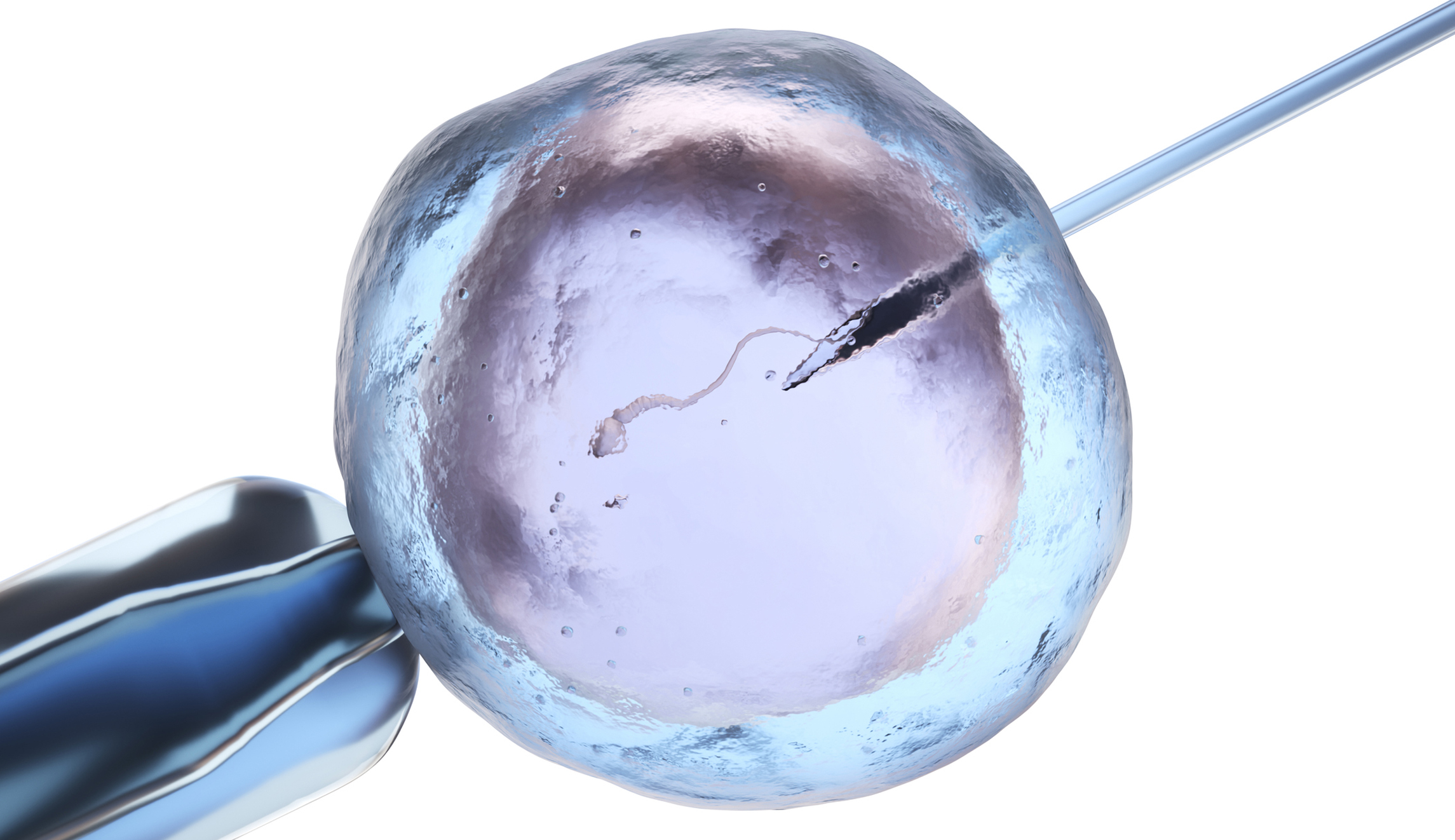 NextImg:Alabama’s IVF reality and its far-reaching impacts: Everything you need to know - Washington Examiner